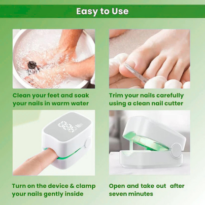 VivaVera™ - Nail Fungus Laser