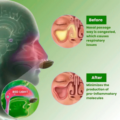 VivaVeraComfyNas™ - Comfortable Nasal Solution